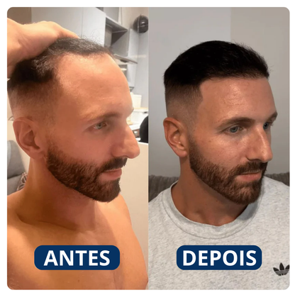 Renovaraiz Sérum Natural para Crescimento Capilar